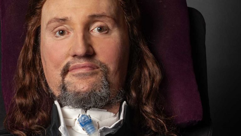 Jason Becker: Krankenhausaufenthalt wegen Kurzatmigkeit